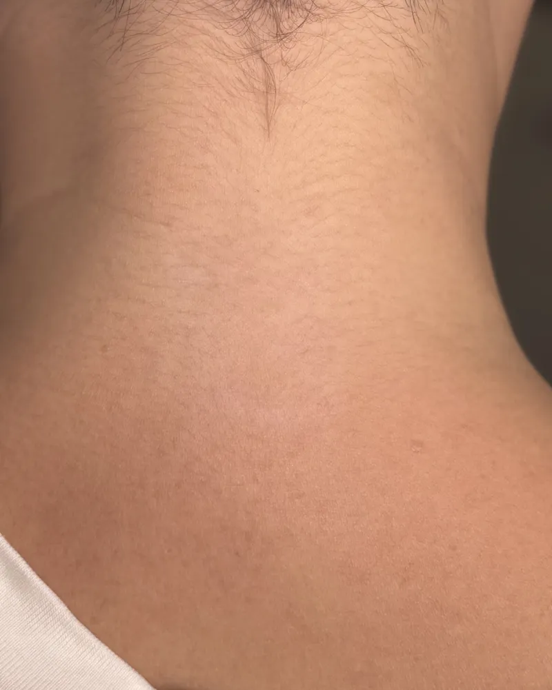 Tattoo Fading after