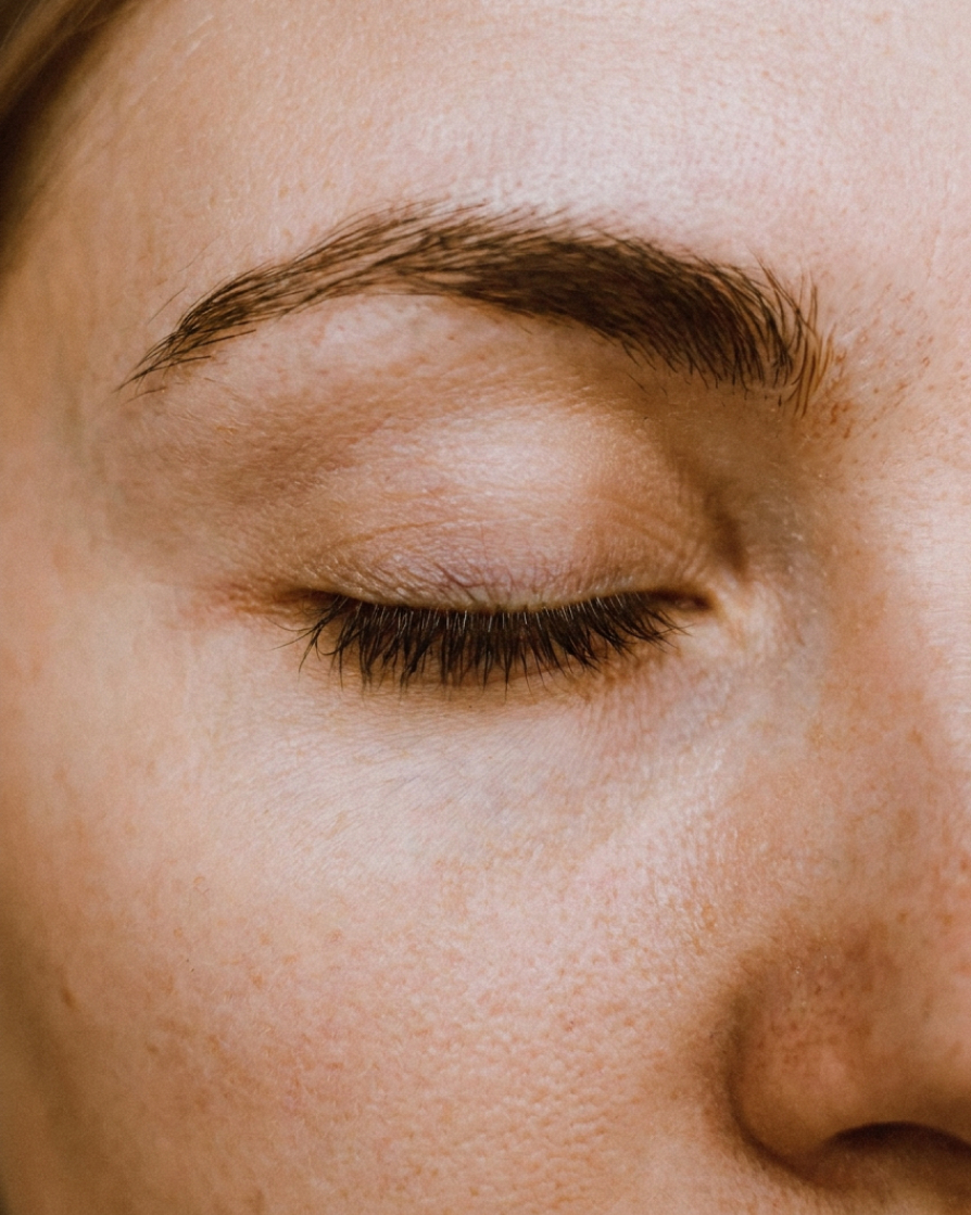 Pigmentation Correction after