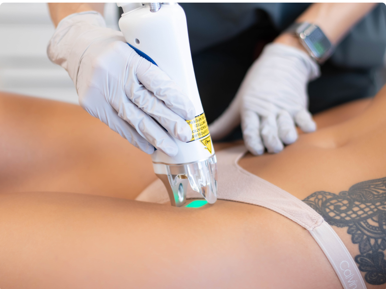 Laser Hair Removal