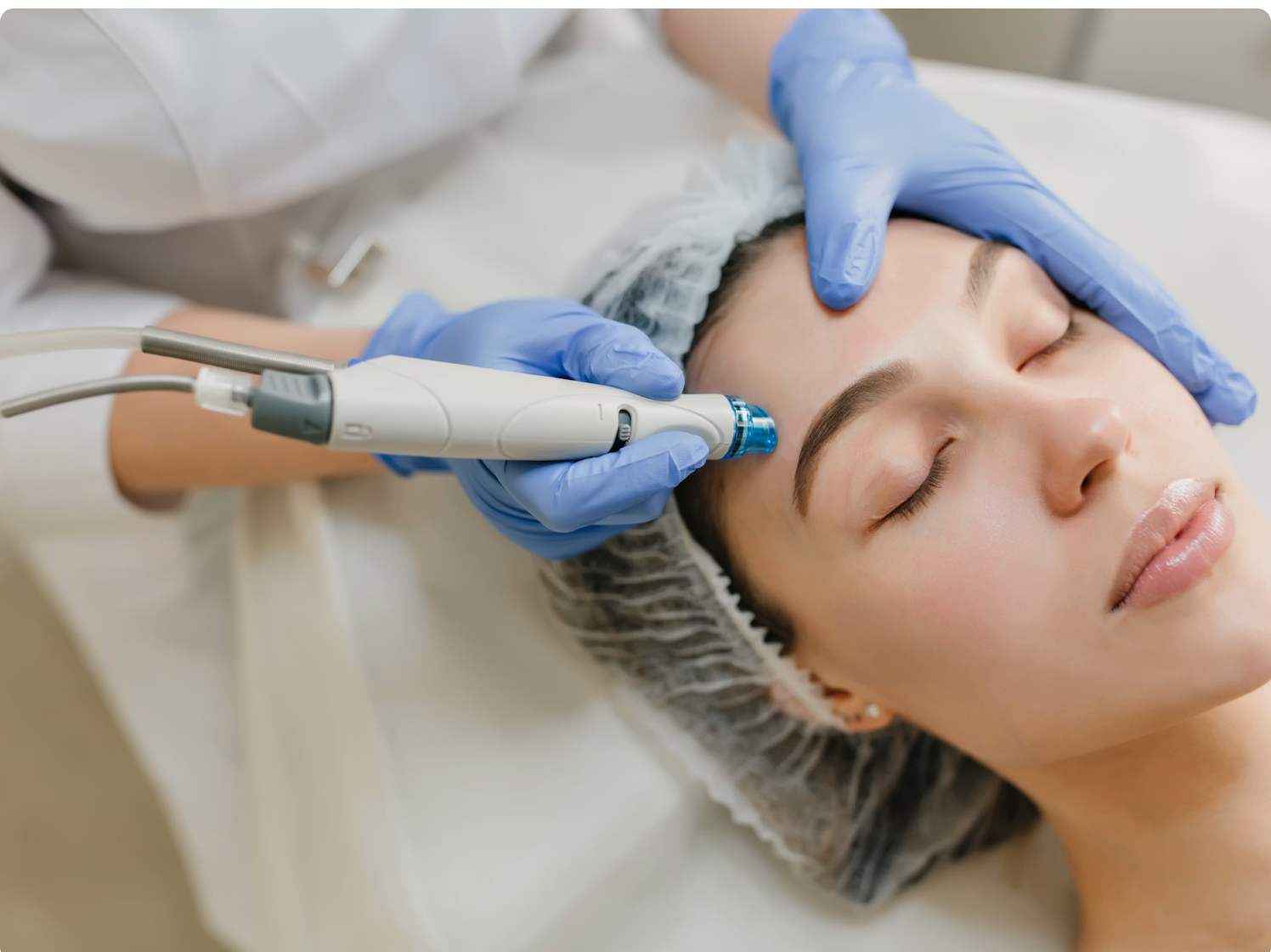 Laser Vascular Treatment